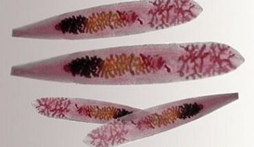 Parasites Opisthorchis dans le corps humain