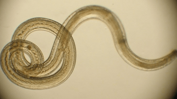 ver parasite du corps humain