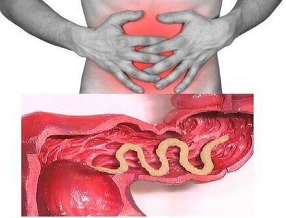 les signes d'helminthiase chronique sont des troubles intestinaux dyspeptiques