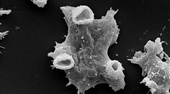 Negleria fowlera est un protozoaire parasite dangereux pour la vie humaine. 